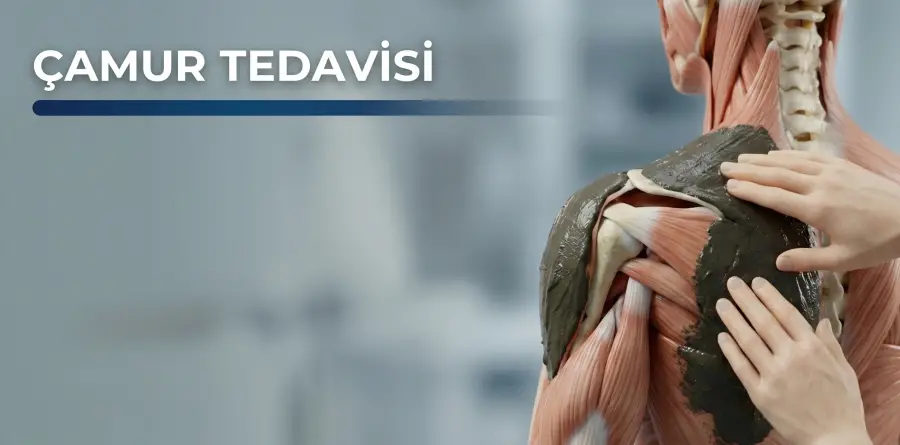 Çamur Tedavisi Çamur Tedavisi