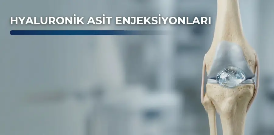 Hyaluronik Asit Enjeksiyonları Hyaluronik Asit Enjeksiyonları