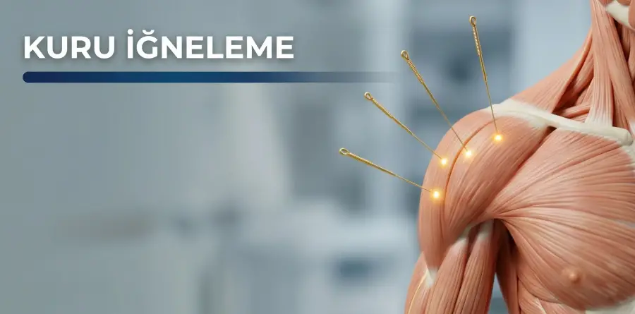 Kuru İğneleme Kuru İğneleme