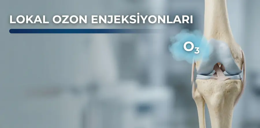 Lokal Ozon Enjeksiyonları Lokal Ozon Enjeksiyonları